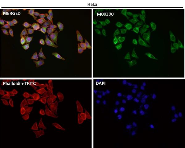 WB - Anti-p62/SQSTM1 Rabbit Monoclonal Antibody ABO14032